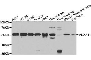 Western blot analysis of extracts of various cell lines, using ANXA11 antibody. (Annexin A11 抗体)