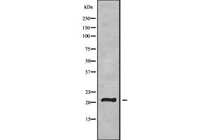 Western blot analysis of TMEM37 using HUVEC whole cell lysates (TMEM37 抗体  (N-Term))
