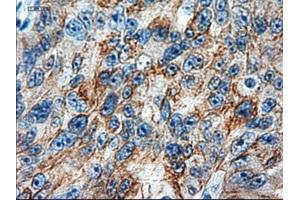 Immunohistochemical staining of paraffin-embedded colon using anti-KRT18 (ABIN2452646) mouse monoclonal antibody. (Cytokeratin 18 抗体  (AA 69-372))