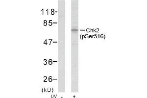 Image no. 1 for anti-Checkpoint Kinase 2 (CHEK2) (pSer516) antibody (ABIN196866) (CHEK2 抗体  (pSer516))