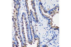Immunohistochemistry of paraffin-embedded rat lung using SCGB1 antibody (6997) at dilution of 1:100 (40x lens). (SCGB1A1 抗体  (AA 22-91))