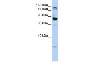 WB Suggested Anti-TJP2  Antibody Titration: 0. (TJP2 抗体  (Middle Region))