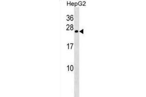 Western Blotting (WB) image for anti-Crystallin, gamma B (CRYGB) antibody (ABIN2998589) (CRYGB 抗体)