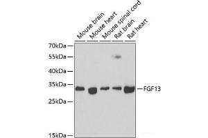 Western blot analysis of extracts of various cell lines using FGF13 Polyclonal Antibody at dilution of 1:1000. (FGF13 抗体)