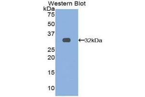 Western Blotting (WB) image for anti-TNF Receptor-Associated Factor 4 (TRAF4) (AA 193-444) antibody (ABIN1860859) (TRAF4 抗体  (AA 193-444))