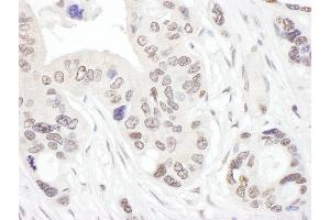 Immunohistochemistry (IHC) image for anti-NHP2 Non-Histone Chromosome Protein 2-Like 1 (NHP2L1) (AA 71-121) antibody (ABIN7453472) (NHP2L1 抗体  (AA 71-121))