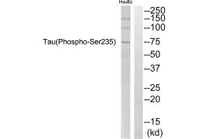 Western blot analysis of extracts from HuvEc cells, using Tau (Phospho-Ser235) Antibody. (tau 抗体  (pSer235))