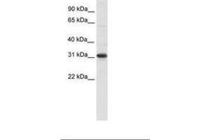 Image no. 1 for anti-Nuclear Receptor Interacting Protein 2 (NRIP2) (AA 27-76) antibody (ABIN6736079) (NRIP2 抗体  (AA 27-76))