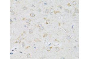 Immunohistochemistry of paraffin-embedded Rat brain using SLC2A13 Polyclonal Antibody at dilution of 1:100 (40x lens). (SLC2A13 抗体)
