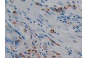 Immunohistochemistry (IHC) image for anti-Protein Tyrosine Phosphatase, Receptor Type, Q (PTPRQ) (AA 36-294) antibody (ABIN7442573)