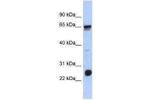 WB Suggested Anti-C1orf103 Antibody Titration: 0. (C1orf103 抗体  (N-Term))