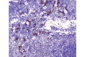 IHC analysis of RASAL1 using anti-RASAL1 antibody (ABIN6719367).