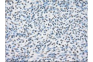 Image no. 1 for anti-Crystallin, alpha B (CRYAB) antibody (ABIN1497647) (CRYAB 抗体)