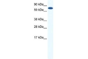 CBFA2T2H antibody used at 0. (CBFA2T2 抗体  (Middle Region))