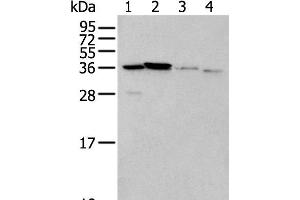 Western blot analysis of 293T cell Mouse brain tissue and Human kidney tissue lysates using LASP1 Polyclonal Antibody at dilution of 1:350