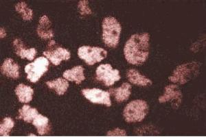Immunofluorescent staining of A431 cells. (ARNT 抗体  (AA 461-574))