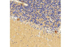 anti-Purinergic Receptor P2X, Ligand-Gated Ion Channel, 7 (P2RX7) (AA 47-311) antibody