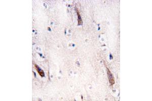 Formalin-fixed and paraffin-embedded human brain tissue reacted with ULK2 antibody (N-term) (ABIN392692 and ABIN2842178) , which was peroxidase-conjugated to the secondary antibody, followed by DAB staining. (ULK2 抗体  (N-Term))