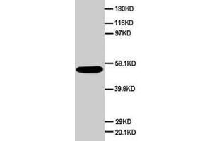 Western blot analysis of HeLa cell lysate. (SCG3 抗体  (C-Term))