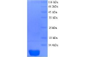 SDS-PAGE (SDS) image for C-X-C Motif Chemokine 10 (CXL10) (AA 22-98) protein (His tag) (ABIN5713388)