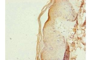 Immunohistochemistry of paraffin-embedded human skin tissue using ABIN7151127 at dilution of 1:100 (RNF114 抗体  (AA 1-228))