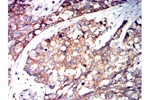 Immunohistochemistry (IHC) image for anti-serpin Peptidase Inhibitor, Clade A (Alpha-1 Antiproteinase, Antitrypsin), Member 1 (SERPINA1) (AA 269-419) antibody (ABIN7193577)