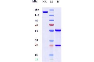 Anti-CD200 Reference Antibody (samalizumab) on SDS-PAGE under reducing (R) condition.