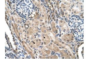 FLJ22167 antibody was used for immunohistochemistry at a concentration of 4-8 ug/ml to stain Epithelial cells of renal tubule (arrows) in Human Kidney. (FLJ22167 (N-Term) 抗体)