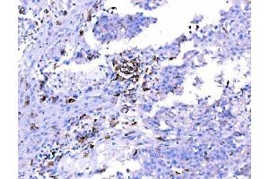 IHC analysis of SH3GL2 using anti-SH3GL2 antibody (ABIN7602229). (SH3G2 抗体  (AA 65-292))