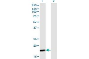 Western Blot analysis of MTP18 expression in transfected 293T cell line by MTP18 MaxPab polyclonal antibody. (Mtfp1 抗体  (AA 1-166))