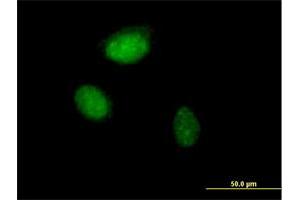 Immunofluorescence of purified MaxPab antibody to ZNF215 on HeLa cell. (ZNF215 抗体  (AA 1-304))