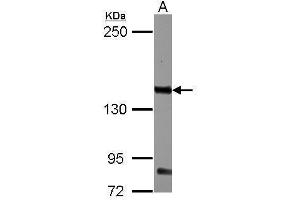 WB Image Sample (30 ug of whole cell lysate) A: K562 5% SDS PAGE antibody diluted at 1:1000 (CD131 抗体  (Center))