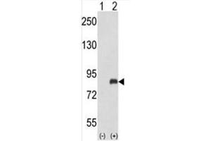 Western blot analysis of ADRBK2 (arrow) using rabbit polyclonal ADRBK2 Antibody (ADRBK2 抗体  (N-Term))