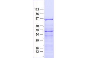 PLA2G4C Protein (His tag)