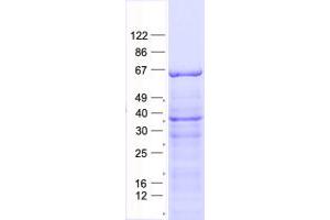 Validation with Western Blot (PLA2G4C Protein (His tag))