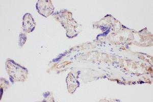 Anti-VEGF Picoband antibody,  IHC(P): Human Placenta Tissue (VEGFA 抗体  (AA 27-191))