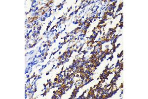 Immunohistochemistry of paraffin-embedded human appendix using NF-κB2 antibody (ABIN7268983) at dilution of 1:100 (40x lens). (NFKB2 抗体)