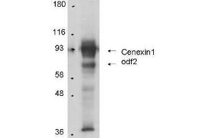 Anti-Cenexin-1 in Western Blot using  Immunochemical's Protein A Purified Anti-Cenexin-1 antibody shows detection of Cenexin-1 in total cell lysates from mouse F9 embryonic carcinoma cells. (ODF2 抗体)