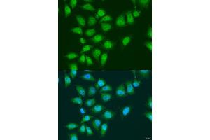 Immunofluorescence analysis of U2OS cells using EYA3 antibody (ABIN6292902) at dilution of 1:100. (EYA3 抗体)
