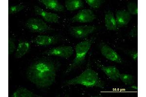 Immunofluorescence of monoclonal antibody to USO1 on HeLa cell. (USO1 抗体  (AA 1-961))