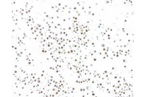 Immunocytochemistry (ICC) image for anti-Lectin, Galactoside-Binding, Soluble, 9 (LGALS9) (AA 305-355) antibody (ABIN7449427)