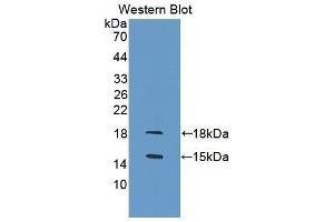 Western blot analysis of the recombinant protein. (GDF3 抗体  (AA 253-366))