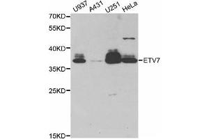 Western Blotting (WB) image for anti-Ets Variant 7 (ETV7) antibody (ABIN1882381) (ETV7 抗体)