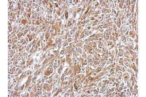 IHC-P Image Immunohistochemical analysis of paraffin-embedded C2C12 xenograft, using Plasminogen, antibody at 1:500 dilution. (PLG 抗体)