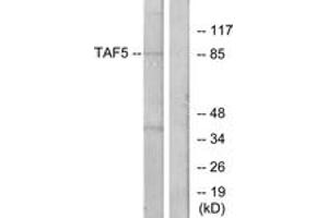 Western Blotting (WB) image for anti-TAF5 RNA Polymerase II, TATA Box Binding Protein (TBP)-Associated Factor, 100kDa (TAF5) (AA 381-430) antibody (ABIN2889608) (TAF5 抗体  (AA 381-430))