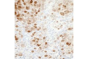 Immunohistochemistry (IHC) image for anti-Nicotinamide phosphoribosyltransferase (NAMPT) (AA 400-450) antibody (ABIN7454014) (Recombinant NAMPT 抗体  (AA 400-450))