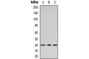 Western blot analysis of HSD3B7 expression in Lovo (A), MCF7 (B), Hela (C) whole cell lysates. (HSD3B7 抗体)