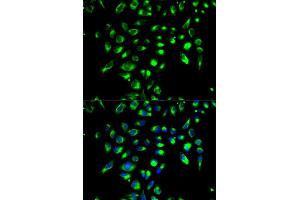Immunofluorescence analysis of MCF-7 cell using CD86 antibody. (CD86 抗体)