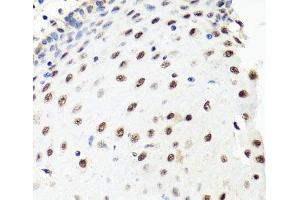 Immunohistochemistry of paraffin-embedded Human esophagus using PRPF8 Polyclonal Antibody at dilution of 1:100 (40x lens). (PRPF8 抗体)