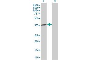 Western Blot analysis of SPO11 expression in transfected 293T cell line by SPO11 MaxPab polyclonal antibody. (SPO11 抗体  (AA 1-358))
